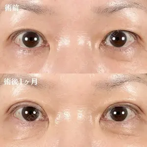 null days after image