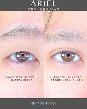before image