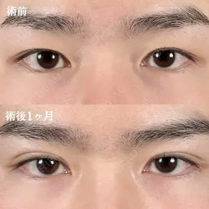 before image