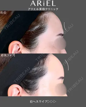 before image