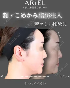 90 days after image