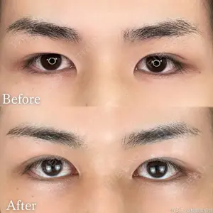 before image