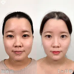 null days after image