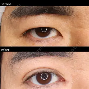 30 days after image