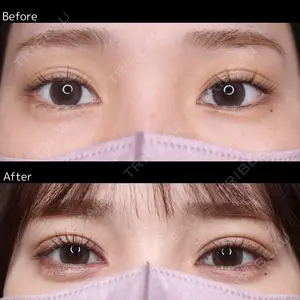 30 days after image