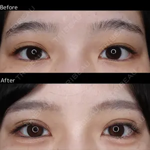 before image