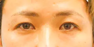 before image