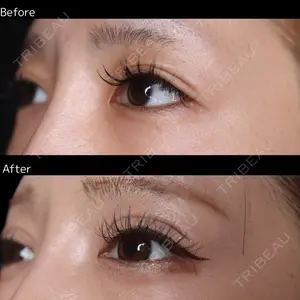 30 days after image