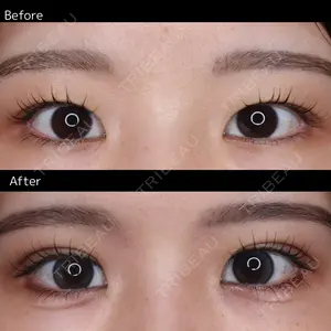 30 days after image