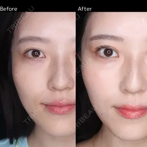 30 days after image