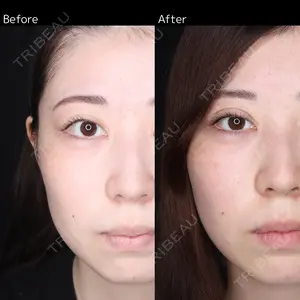 30 days after image