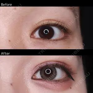 before image
