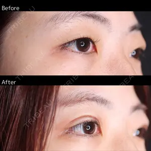 30 days after image