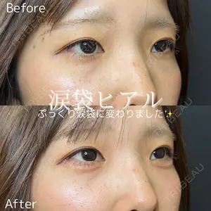 before image