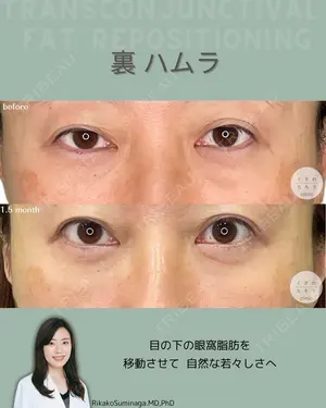before image