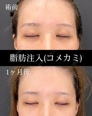 30 days after image