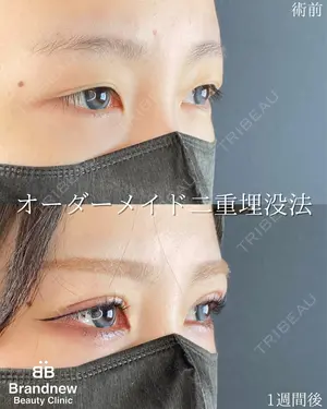 before image