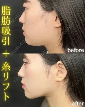 90 days after image