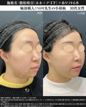 90 days after image