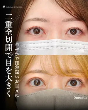 150 days after image