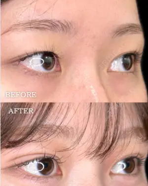 before image