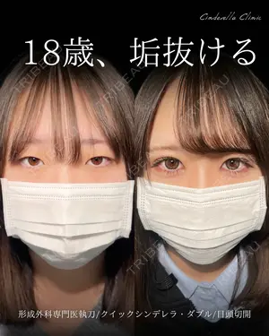 30 days after image