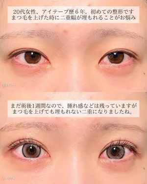 7 days after image