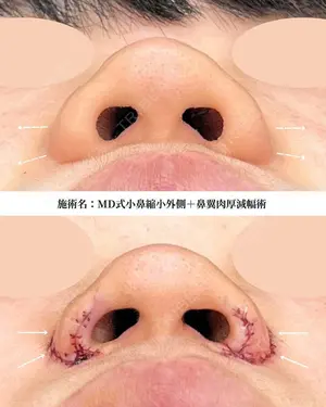 before image
