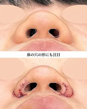 0 days after image