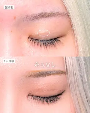 30 days after image