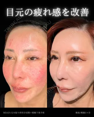 30 days after image