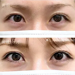 before image