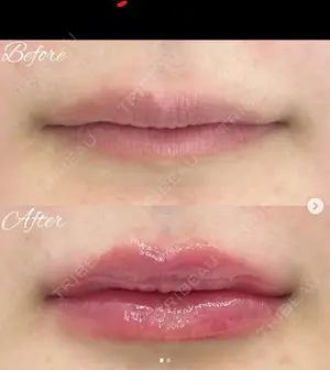 0 days after image