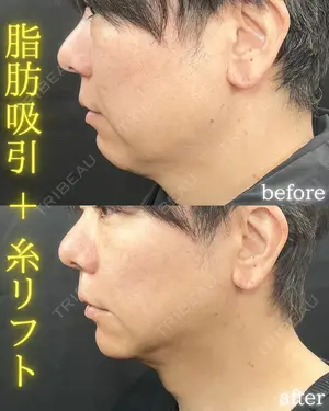 90 days after image