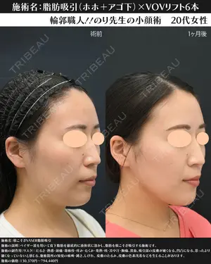 30 days after image
