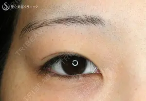 before image