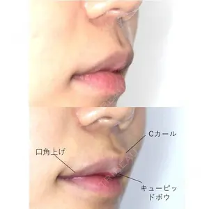 before image