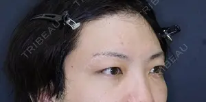 60 days after image