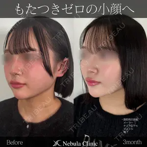 90 days after image