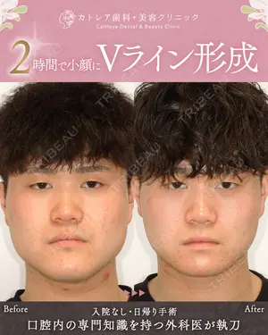 180 days after image