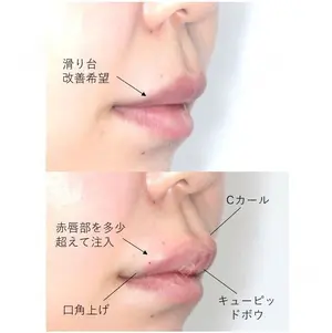 before image