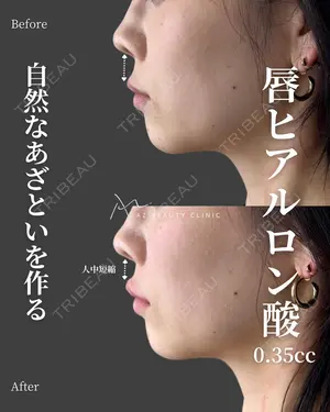 0 days after image