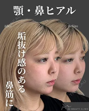 0 days after image
