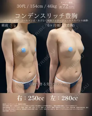 180 days after image