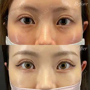 before image