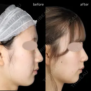 before image