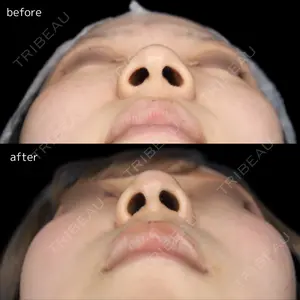 before image
