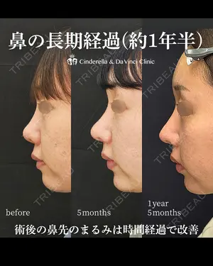 515 days after image