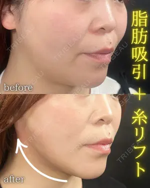 5 days after image
