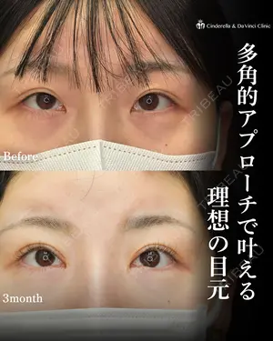 90 days after image